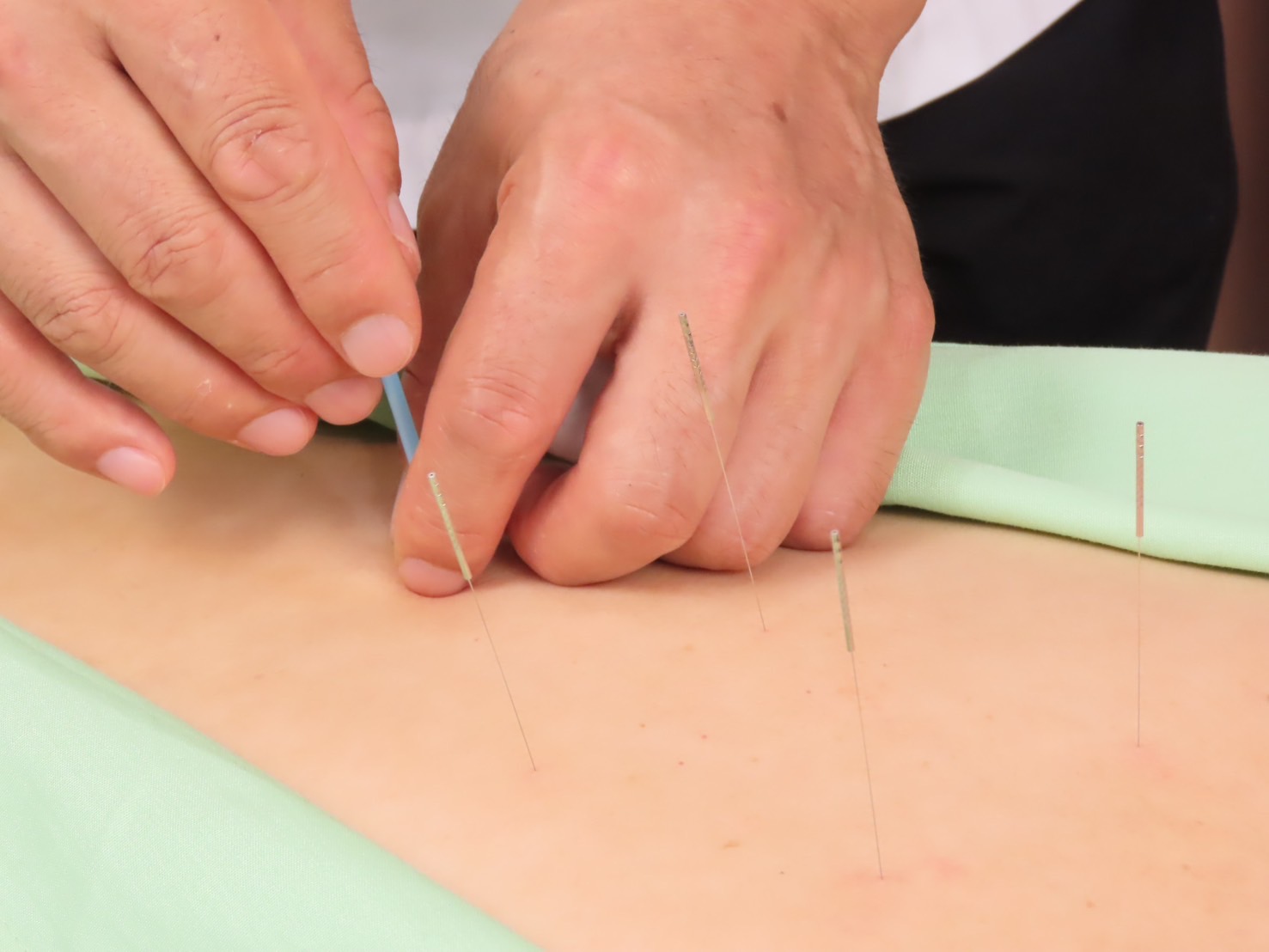 なぜあなたの頭痛はマッサージでは改善しないのか